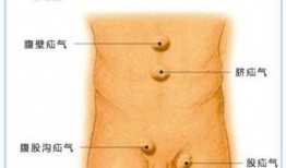 疝气手术可以吃瓜吗,疝气手术患者可否食用瓜果的探讨